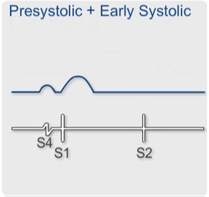 Angina Pectoris