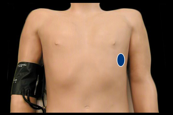 Precordial Impulse - normal location and size