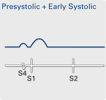 Hyperkinetic