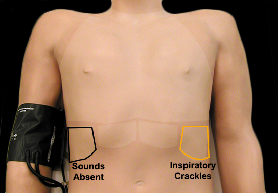 auscultation areas review