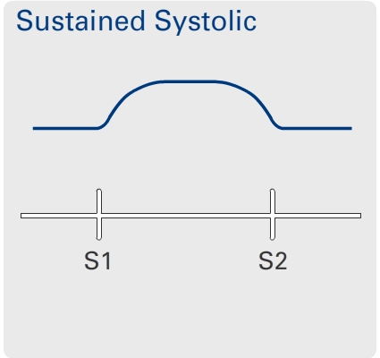 Sustained