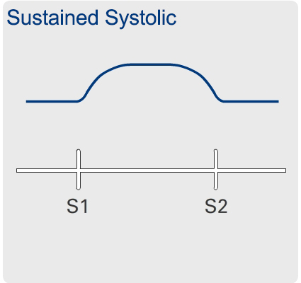 Hyperkinetic