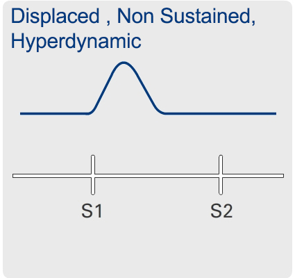 Hyperkinetic